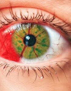 cute beauty face model red-veined veins artery red one teardrop and green eyes inside eye